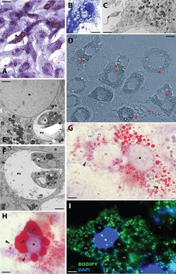 Causative Agents of American Tegumentary Leishmaniasis Are Able to Infect 3T3-L1 Adipocytes In Vitro